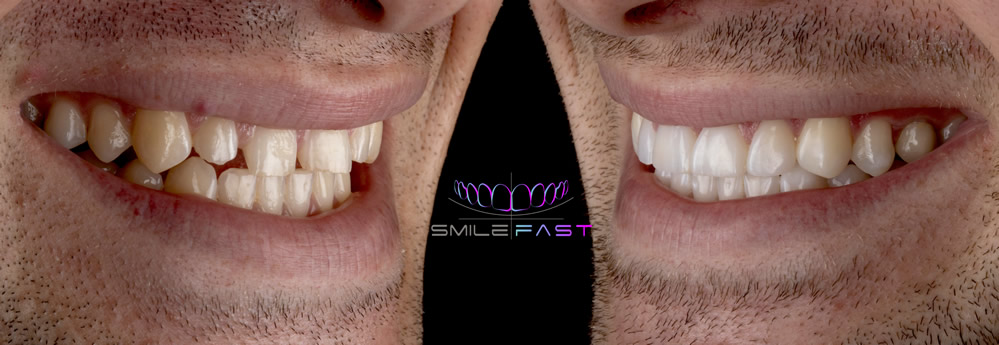 Smilefast Case study