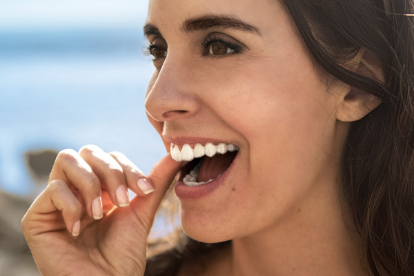 Wearing Invisalign clear aligner